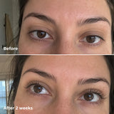 Eyelash Growth Serum